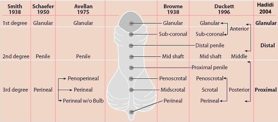 Fig. 1: Different classification of hypospadias
